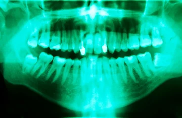 dental-x-ray